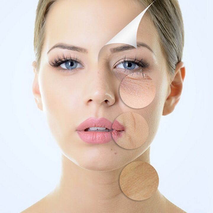 Imperfecciones de la piel del rostro indicaciones de cirugía antienvejecimiento. 
